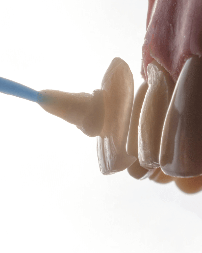 Light green clean dentist reminder instagram post (800 x 1000 px)